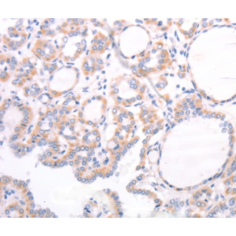 Immunohistochemistry - TRPC7 Antibody from Signalway Antibody (35976) - Antibodies.com