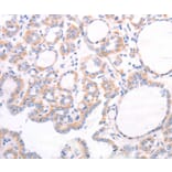 Immunohistochemistry - TRPC7 Antibody from Signalway Antibody (35976) - Antibodies.com