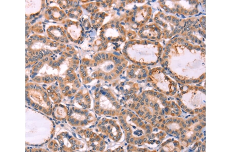 Immunohistochemistry - PROS1 Antibody from Signalway Antibody (35990) - Antibodies.com
