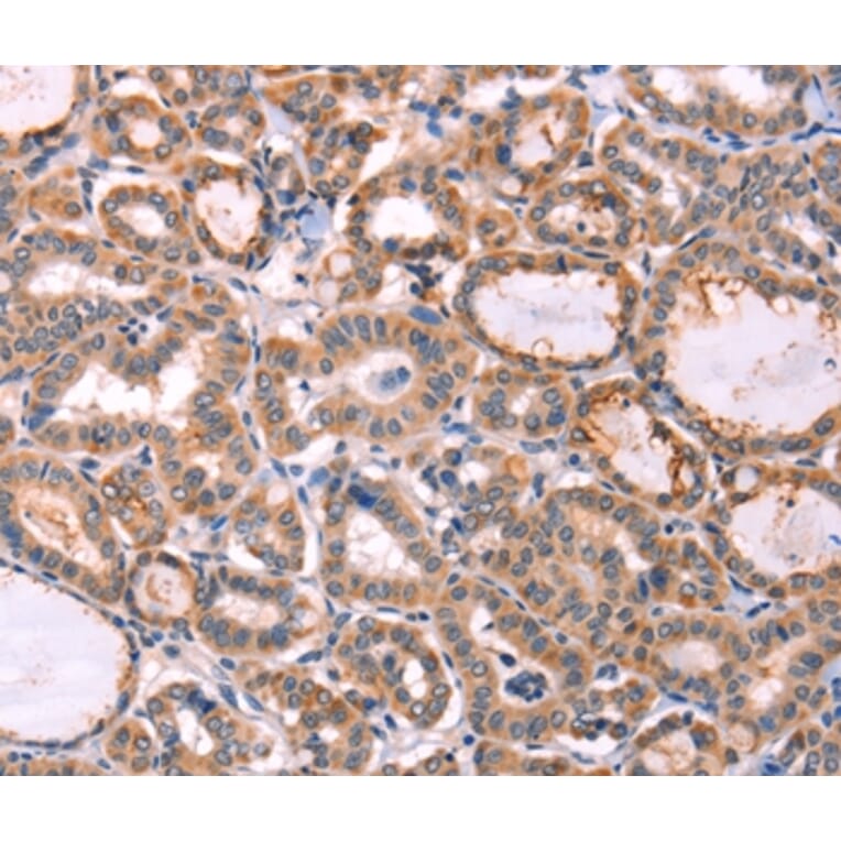 Immunohistochemistry - PROS1 Antibody from Signalway Antibody (35990) - Antibodies.com