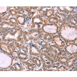 Immunohistochemistry - PROS1 Antibody from Signalway Antibody (35990) - Antibodies.com