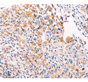 Immunohistochemistry - PGBD1 Antibody from Signalway Antibody (35995) - Antibodies.com