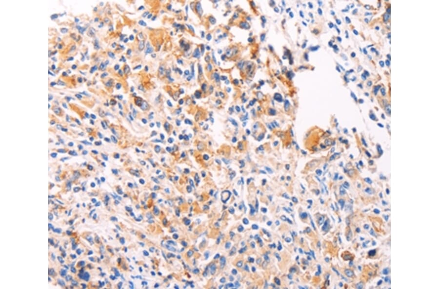 Immunohistochemistry - PGBD1 Antibody from Signalway Antibody (35995) - Antibodies.com