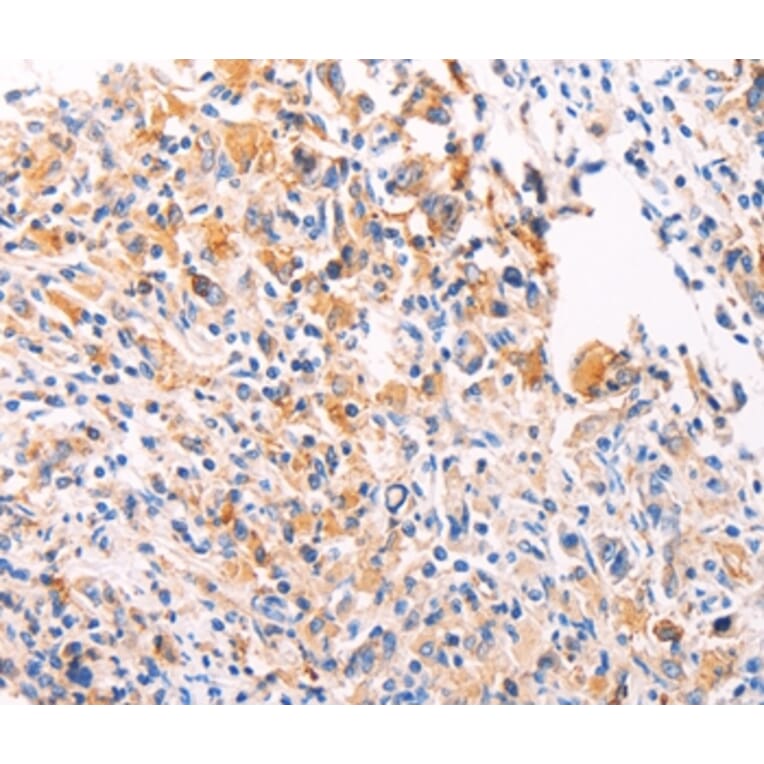 Immunohistochemistry - PGBD1 Antibody from Signalway Antibody (35995) - Antibodies.com