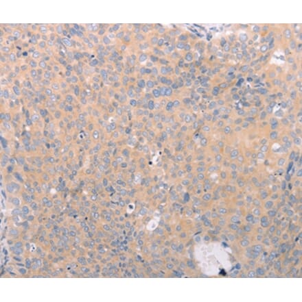 Immunohistochemistry - ABCF3 Antibody from Signalway Antibody (36005) - Antibodies.com