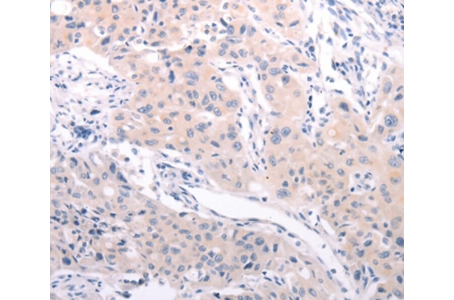 Immunohistochemistry - ABCF3 Antibody from Signalway Antibody (36005) - Antibodies.com