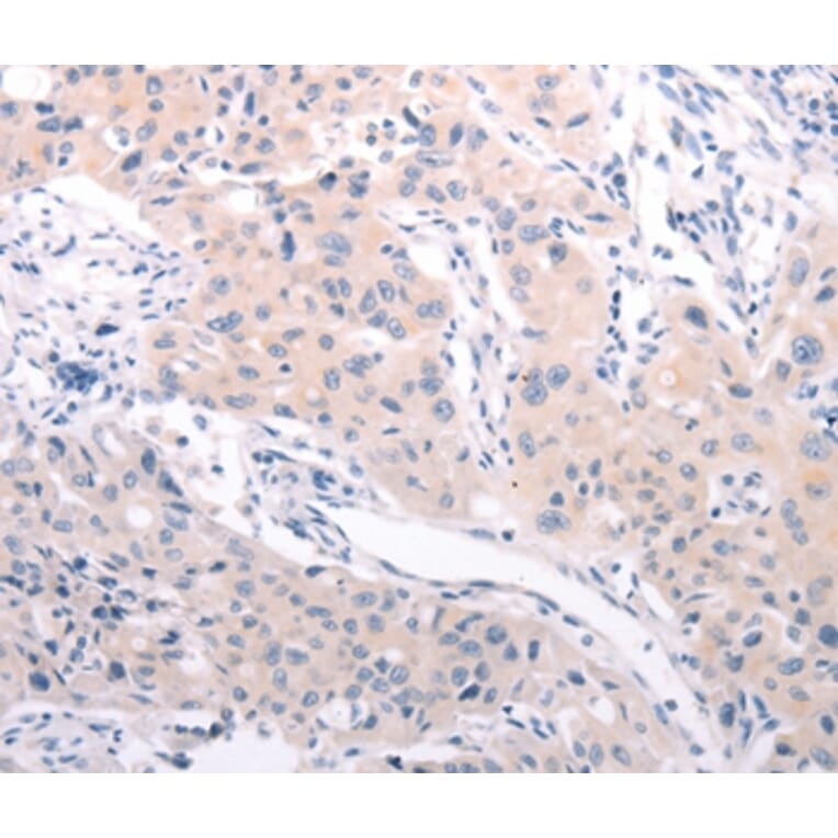 Immunohistochemistry - ABCF3 Antibody from Signalway Antibody (36005) - Antibodies.com