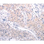 Immunohistochemistry - ABCF3 Antibody from Signalway Antibody (36005) - Antibodies.com