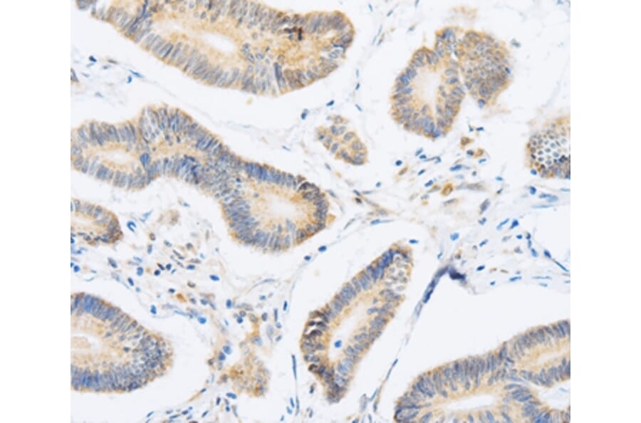 Immunohistochemistry - ABHD1 Antibody from Signalway Antibody (36009) - Antibodies.com