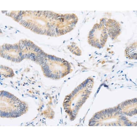 Immunohistochemistry - ABHD1 Antibody from Signalway Antibody (36009) - Antibodies.com