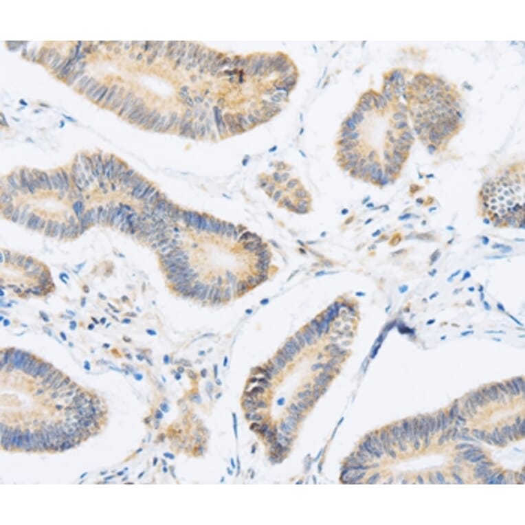 Immunohistochemistry - ABHD1 Antibody from Signalway Antibody (36009) - Antibodies.com