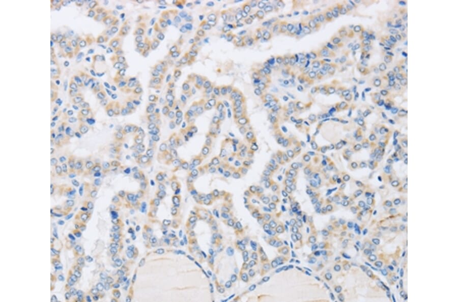 Immunohistochemistry - ABHD1 Antibody from Signalway Antibody (36009) - Antibodies.com