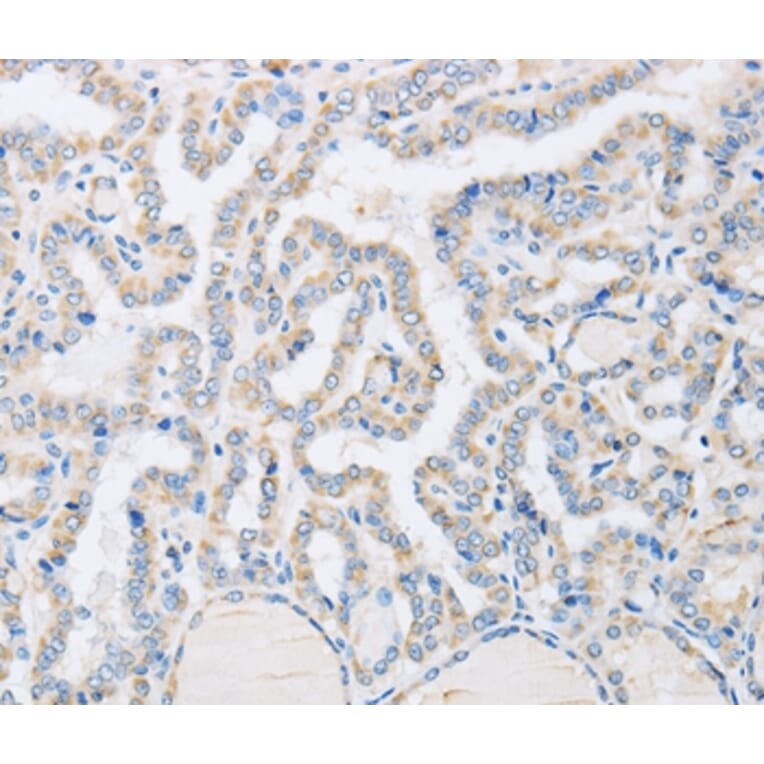 Immunohistochemistry - ABHD1 Antibody from Signalway Antibody (36009) - Antibodies.com