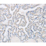 Immunohistochemistry - ABHD1 Antibody from Signalway Antibody (36009) - Antibodies.com