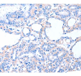 Immunohistochemistry - ACAD8 Antibody from Signalway Antibody (36014) - Antibodies.com