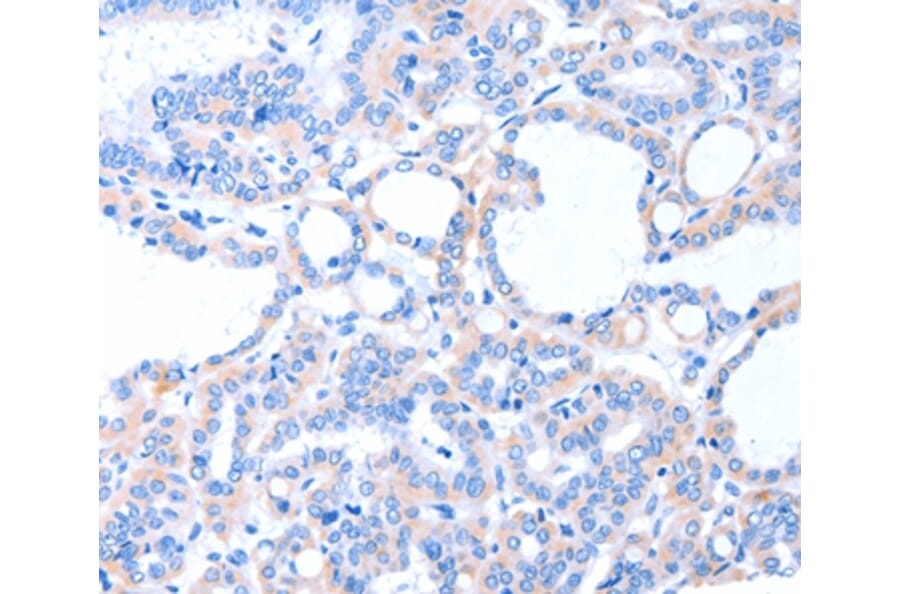 Immunohistochemistry - ACAD8 Antibody from Signalway Antibody (36014) - Antibodies.com