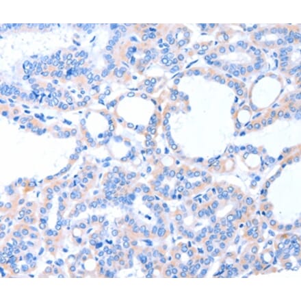 Immunohistochemistry - ACAD8 Antibody from Signalway Antibody (36014) - Antibodies.com