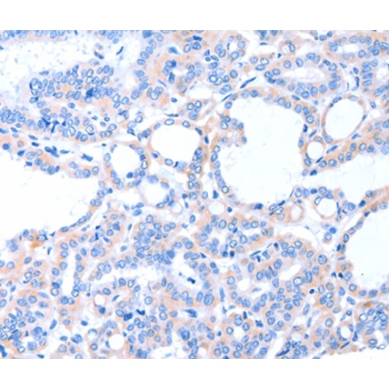 Immunohistochemistry - ACAD8 Antibody from Signalway Antibody (36014) - Antibodies.com