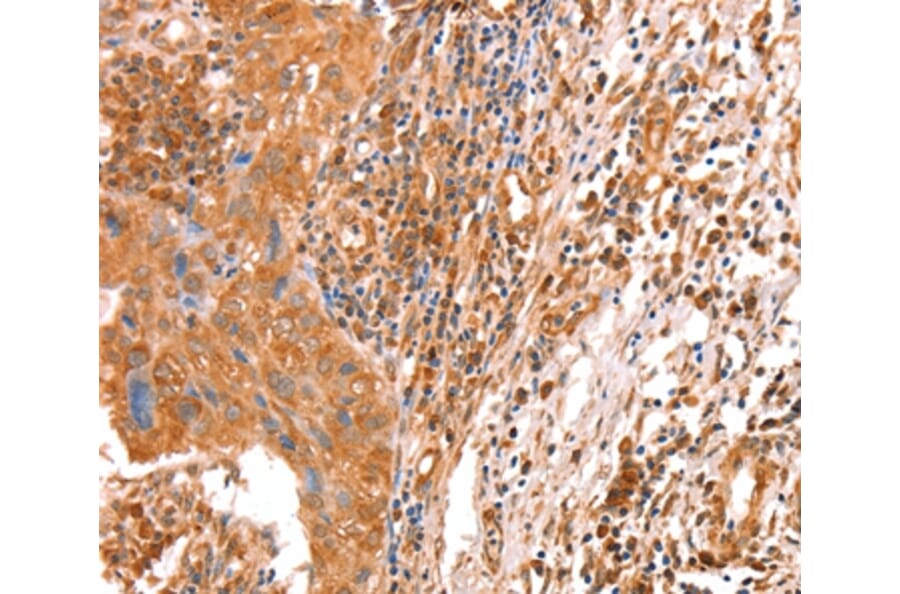 Immunohistochemistry - ACAD9 Antibody from Signalway Antibody (36015) - Antibodies.com