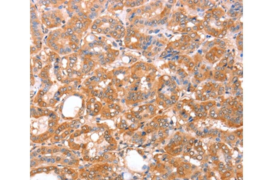 Immunohistochemistry - ACAD9 Antibody from Signalway Antibody (36015) - Antibodies.com