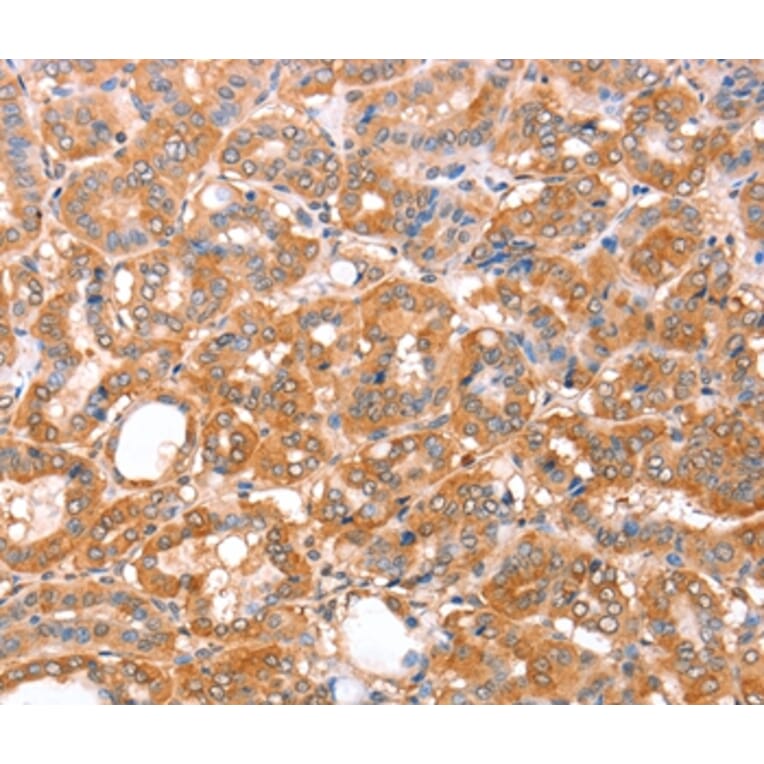 Immunohistochemistry - ACAD9 Antibody from Signalway Antibody (36015) - Antibodies.com