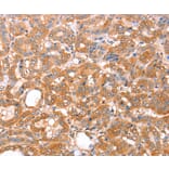 Immunohistochemistry - ACAD9 Antibody from Signalway Antibody (36015) - Antibodies.com