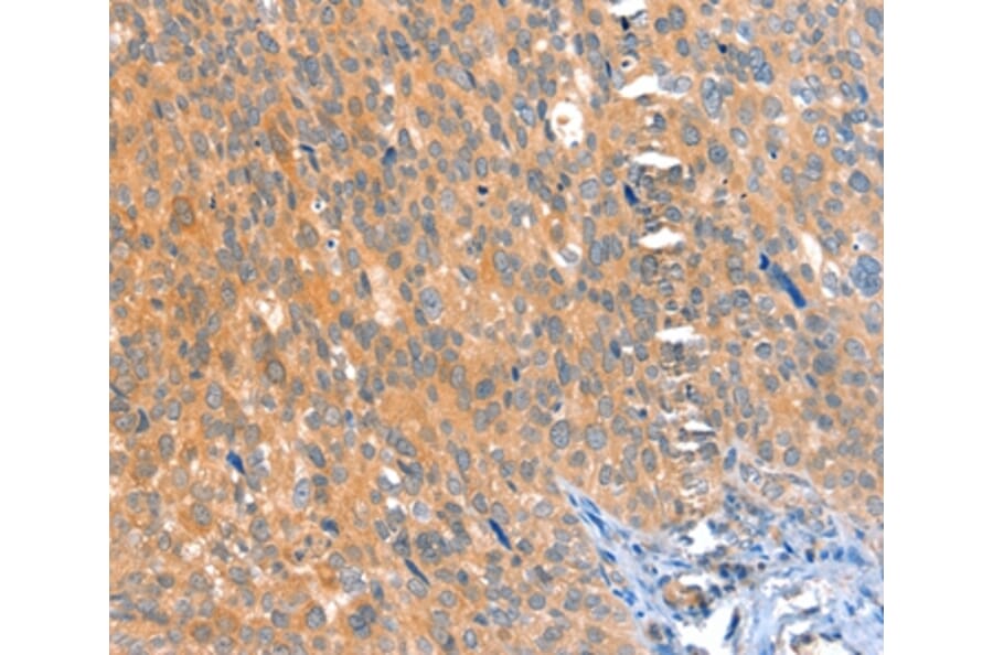 Immunohistochemistry - ACOX3 Antibody from Signalway Antibody (36022) - Antibodies.com