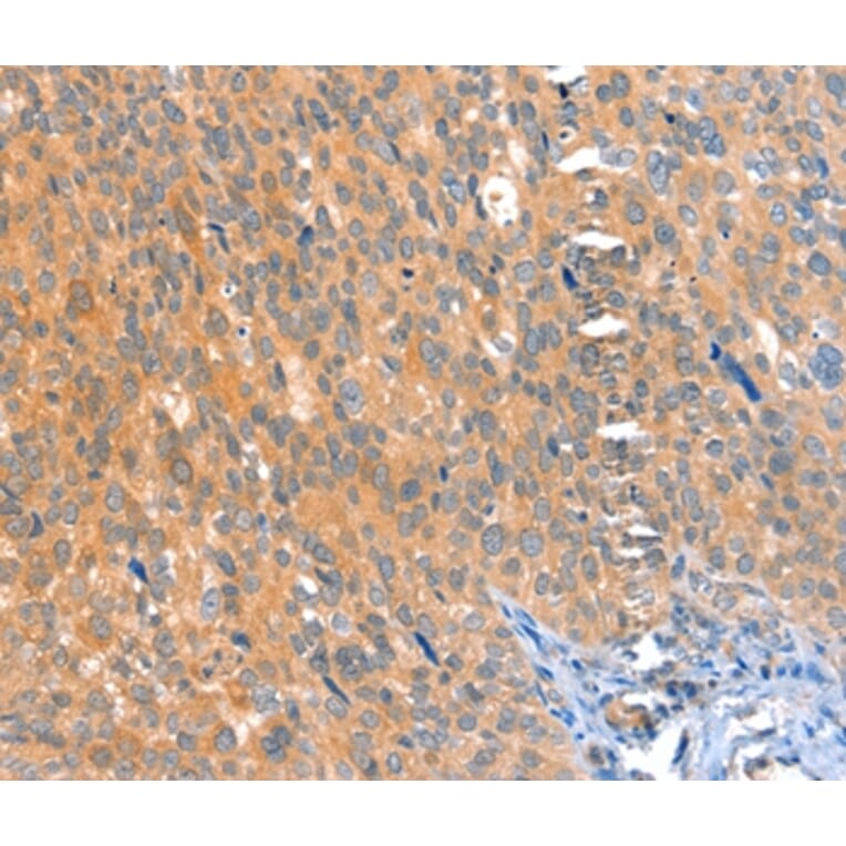 Immunohistochemistry - ACOX3 Antibody from Signalway Antibody (36022) - Antibodies.com