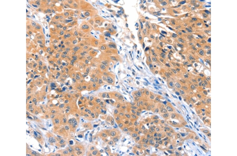 Immunohistochemistry - ACOX3 Antibody from Signalway Antibody (36022) - Antibodies.com
