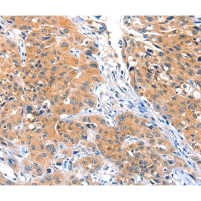 Immunohistochemistry - ACOX3 Antibody from Signalway Antibody (36022) - Antibodies.com