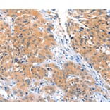 Immunohistochemistry - ACOX3 Antibody from Signalway Antibody (36022) - Antibodies.com