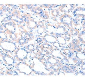 Immunohistochemistry - ACSM5 Antibody from Signalway Antibody (36025) - Antibodies.com