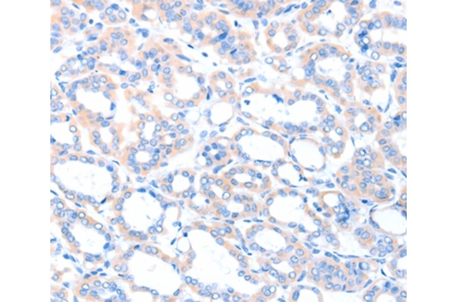 Immunohistochemistry - ACSM5 Antibody from Signalway Antibody (36025) - Antibodies.com