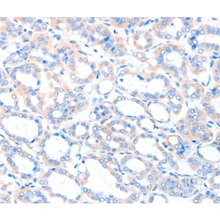 Immunohistochemistry - ACSM5 Antibody from Signalway Antibody (36025) - Antibodies.com