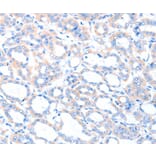 Immunohistochemistry - ACSM5 Antibody from Signalway Antibody (36025) - Antibodies.com