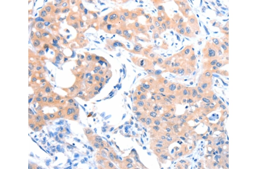Immunohistochemistry - ACSM5 Antibody from Signalway Antibody (36025) - Antibodies.com