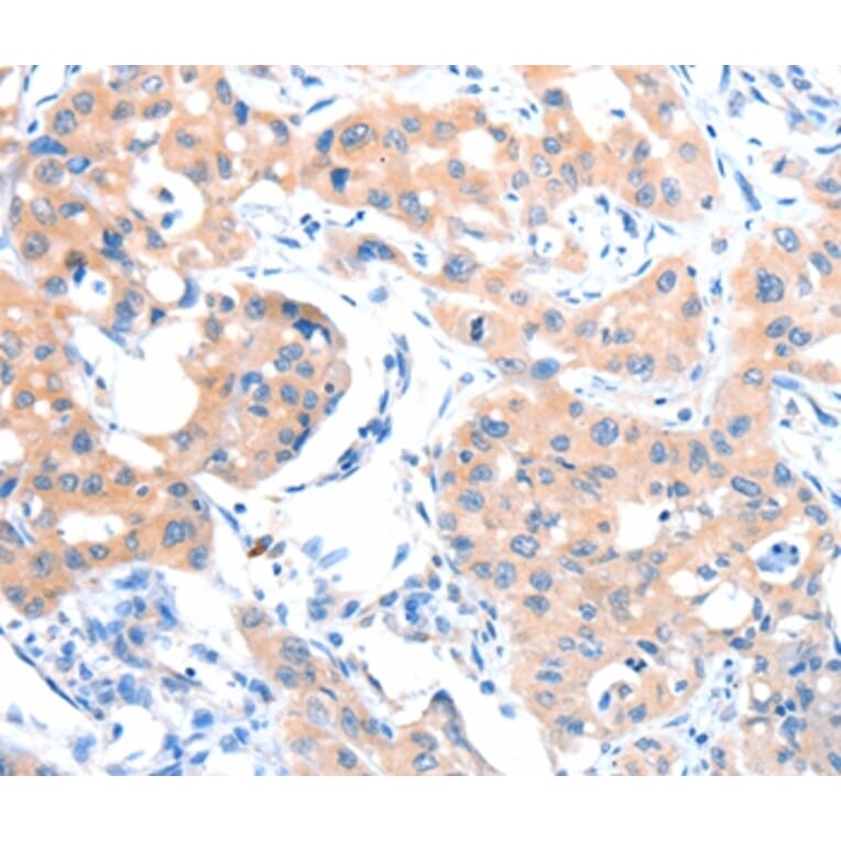 Immunohistochemistry - ACSM5 Antibody from Signalway Antibody (36025) - Antibodies.com