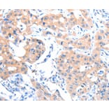 Immunohistochemistry - ACSM5 Antibody from Signalway Antibody (36025) - Antibodies.com