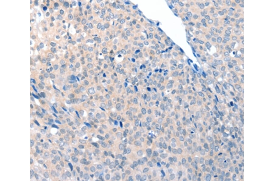 Immunohistochemistry - ACOT8 Antibody from Signalway Antibody (36036) - Antibodies.com