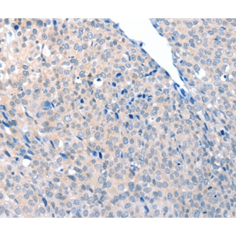 Immunohistochemistry - ACOT8 Antibody from Signalway Antibody (36036) - Antibodies.com