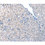 Immunohistochemistry - ACOT8 Antibody from Signalway Antibody (36036) - Antibodies.com