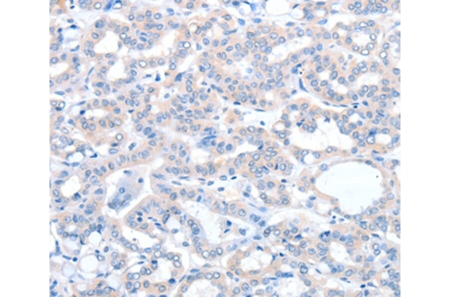 Immunohistochemistry - ACOT8 Antibody from Signalway Antibody (36036) - Antibodies.com
