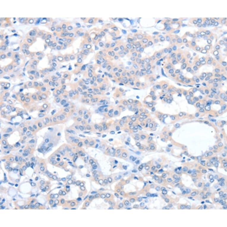 Immunohistochemistry - ACOT8 Antibody from Signalway Antibody (36036) - Antibodies.com