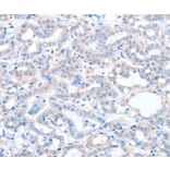 Immunohistochemistry - ACOT8 Antibody from Signalway Antibody (36036) - Antibodies.com