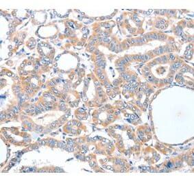 Immunohistochemistry - ADCK1 Antibody from Signalway Antibody (36048) - Antibodies.com