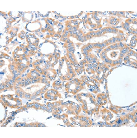 Immunohistochemistry - ADCK1 Antibody from Signalway Antibody (36048) - Antibodies.com