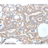 Immunohistochemistry - ADCK1 Antibody from Signalway Antibody (36048) - Antibodies.com