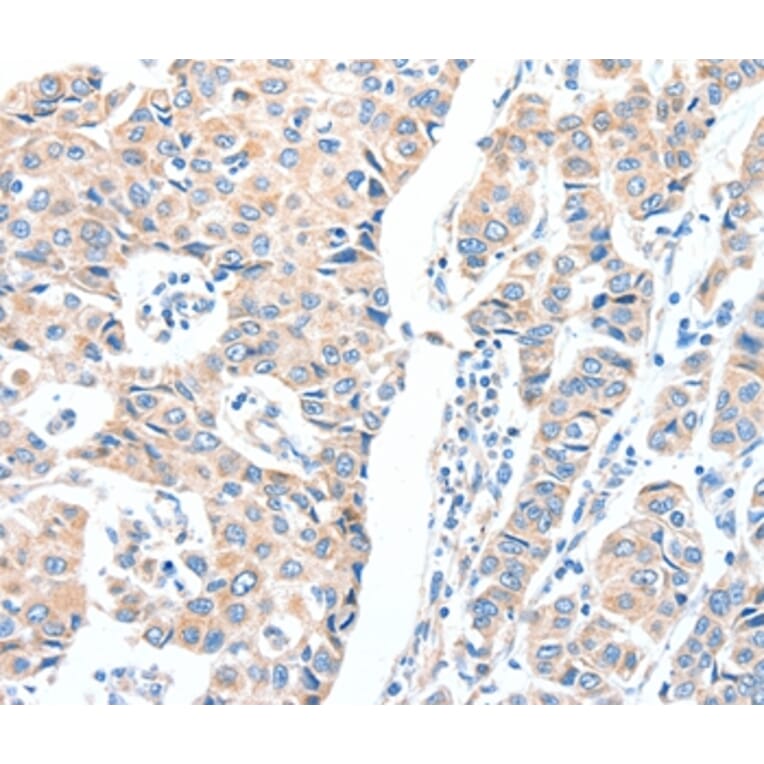 Immunohistochemistry - ADCK1 Antibody from Signalway Antibody (36048) - Antibodies.com