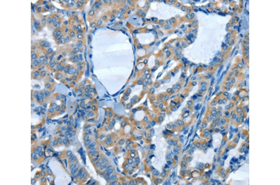 Immunohistochemistry - ADCK4 Antibody from Signalway Antibody (36049) - Antibodies.com