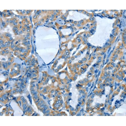 Immunohistochemistry - ADCK4 Antibody from Signalway Antibody (36049) - Antibodies.com